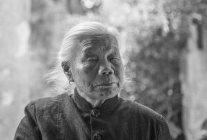 シミやシワに効果的な高周波機器の使い方は？