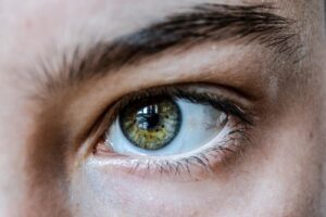 目元の下まぶたにできるシワを改善する方法は？