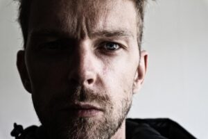 目元のシワを改善する方法は？
